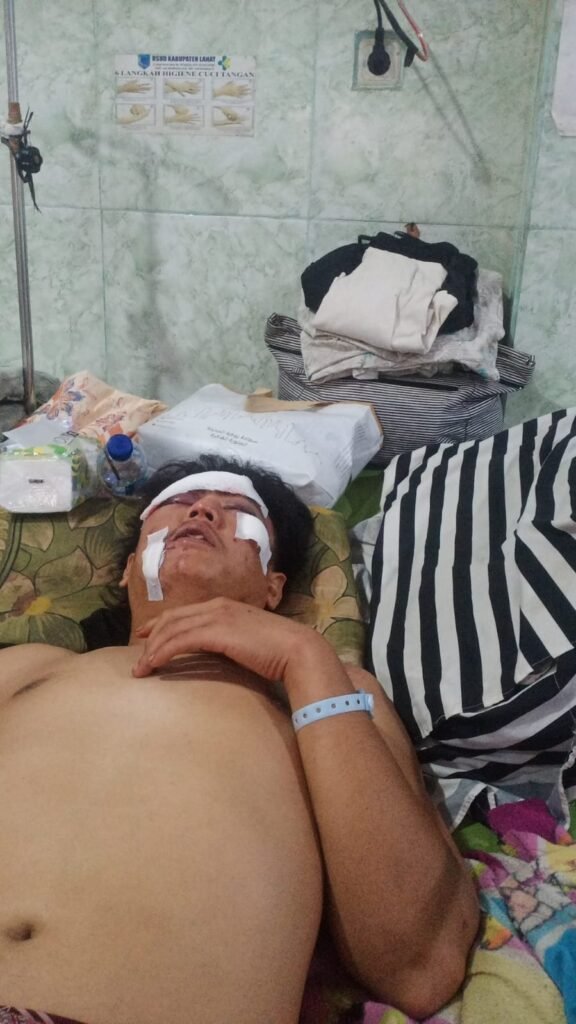 Polsek Kikim Tiimur,Tidak Serius Menangani Kasus Penganiayaan Berat Di Desa Bunga Mas Kikim Timur Kuasa Hukum Korban Desak Polda Sumsel Ambil Alih